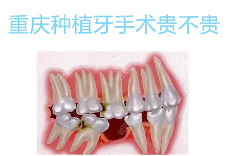 你是否曾经在听到“洗牙”这个词时，会担心它要花费很长时间？今天我们就来聊聊洗牙的整个过程到底需要多久。牙齿健康的重要性：首先，我们需要了解定期洗牙对于口腔卫生和整体健康的意义。